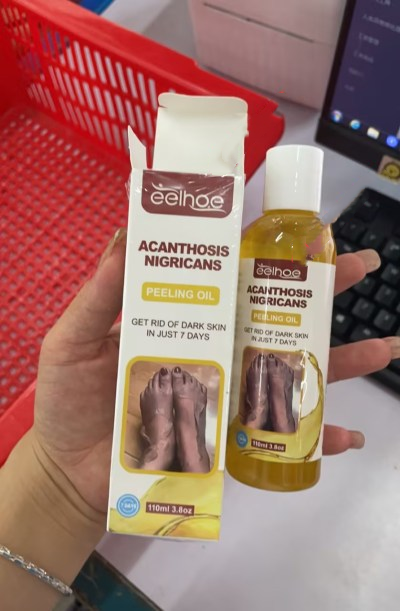 Acanthosis Nigricans Peeling Oil: Gentle Skin Renewal Solution